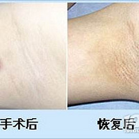 �к�������ˮ�����ʵ��䷴������ҽ����ͬ�ٸ����������Ʒ�����