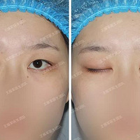 ���������޸�����˫��Ƥ֮���ұ���һ����