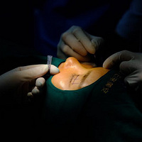 �������۽��޸������۽ǿ�̫����ô�޸�