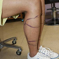 ��ë��ֲ����ӭΧ��