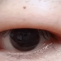 �����ࣺΪʲô�ܶ������۵�С��Ů������˫��Ƥ�أ�