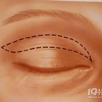 �����ࣺ����˫��Ƥ��ԭ����ô�򵥣�