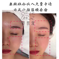 ����΢��