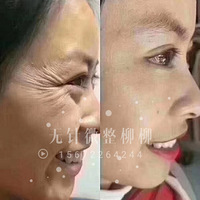 ����΢��