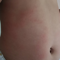 �ٰ���һ ɽ �� �ᡱ��Ӿ�ز���꣬�¶��˺��׽�ҽԺ