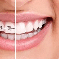 ���ݽ����������˽�Ķ������