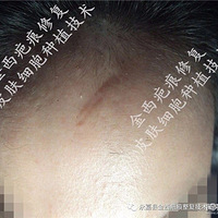 ϸ����ֲ�̺������յ�վ��