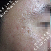 ϸ����ֲ�ΰ̺ڿƼ���