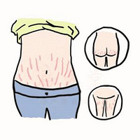 ������һ����ôȥ�� ����ȥ�����ϵ�������