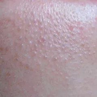 ��ս�پ��������𶻶��İ취���Ҳ�99%���˶���֪������