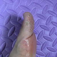 ���ڻָ���Ů����