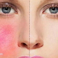 ��Ѫ˿��ôȥ��������һ���򵥵ķ���