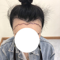 ֲ������|�������ഺ��ֲ�������ռ�