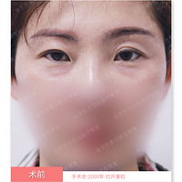 ����Ƥ�ɳڣ�����׸Ƥ,��С�۲�������ԭ��