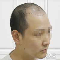 ����ͷ�����ܰ�������