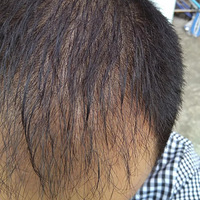 ֲ������Ͷ�壨��ֲ����������142�죩