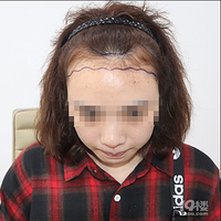 ��ͷ����������������ֲ