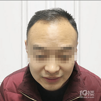 ��ͷ��������ͷ��������ֲ����