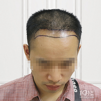 ��ͷ����������������ֲ��������