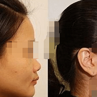 �沿��䣬������VS����֬����