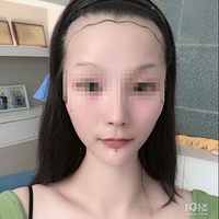 ���Ѿ�ֲ��100����~