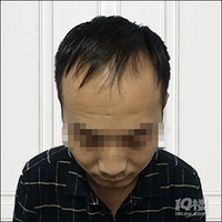 ��ͷ���ʼǡ�ֲ��388���¼