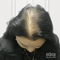 ��ͷ���ʼǡ�ͷ��������ֲ488���¼