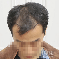 ��ͷ���ʼǡ�ͷ��������ֲ��������