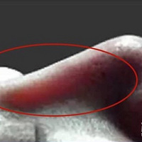 ���޸��󿧴���ԴԺ��ר�ã�mesh���ϱ����պ���ӻ�������?