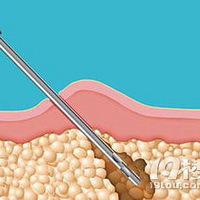 ����ʱ������-������֬�����ܣ���Ӧ��֪����Щ��