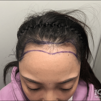 ��ͷ���ʼǡ���11.4����ֲ������