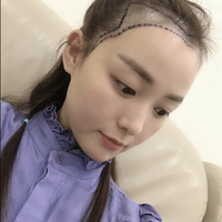 ��ͷ���ʼǡ���8.06����ֲ��¼