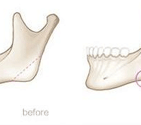 ����ʱ������-����|����������沿�����ĸı��ж��