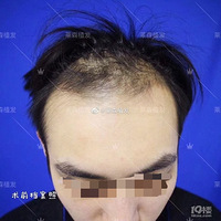 ������ɭֲ��ͷ����ֲ9����~