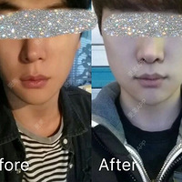 �Ȱ�զ�����ˡ�