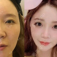 �����ռ�:��ŷ�����ȱǻ��׻��ͣ������Ů��ײ��baby��