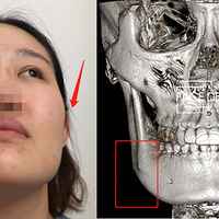 ��������Ь���������ϳ���������40�򶯹Ǵ�����������ã�