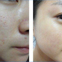 ĸ��ȥ������ȫ���ڣ�30����Ů���ڷ������Ƕ���˭�����ң�