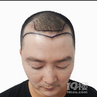 ����ֲ������