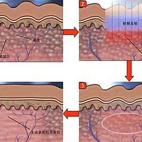 ��������˸��ÿ�����Ϊ�κÿ�С����࣬����������ȴ���٣�