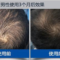 �����ෲ����ʹŮ��ͷͺ��������û����������ɣ�