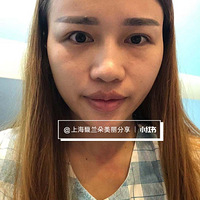 #�����ǰ������� ¡�ǵ�����Ч��������ô����