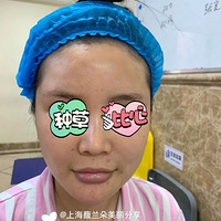 #�����߹Ǳǵ��ɱ����_�Ϻ��³�Ⱥ����