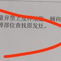 5.9 一转眼2个月过去了 我们还在等待