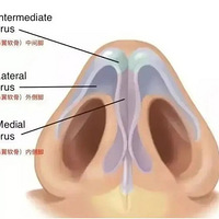 ���ƱǼ��������������Щ