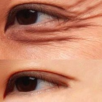 ��Ѫ��������˥��ȫ�����ҵ��׸���ʲô