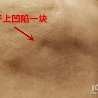 ��֬���ʣ�������֬��ȫ�Ը���