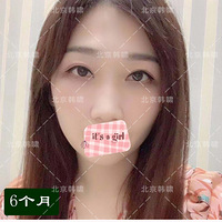 ˫��Ƥ����������ˮ�������޸���