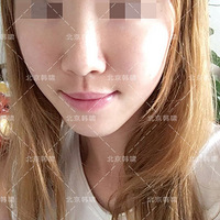 �沿֬�����