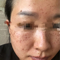 ��������ô����İ����ڽ�����ˣ�Ƥ�밲����